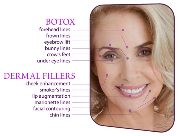 Mandarin Botox