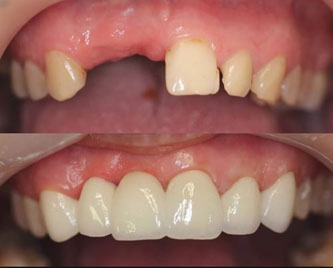 case5