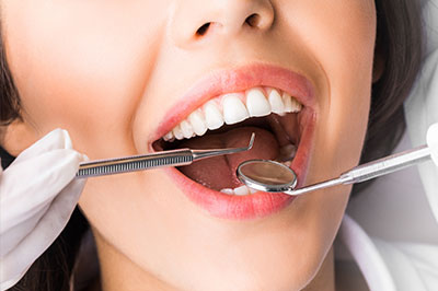 Periodontal Surgery Jacksonville