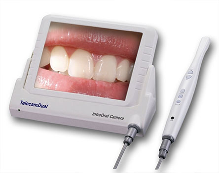 intraoral camera Mandarin