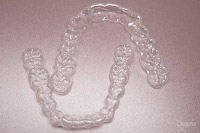 Mandarin Retainers