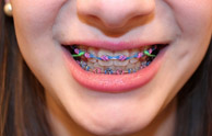 Jacksonville Orthodontist