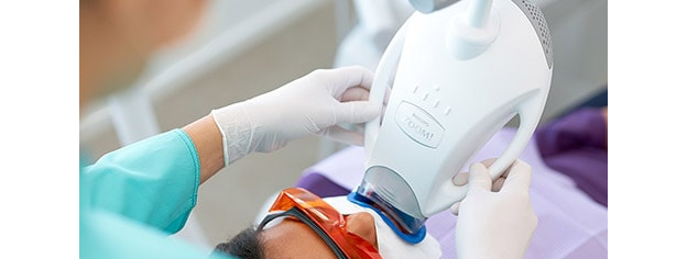 Mandarin Teeth Whitening